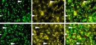 Long-Term Excessive Alcohol Consumption Enhances Myelination in the Mouse Nucleus Accumbens