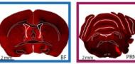 An early surge of norepinephrine along brainstem pathways drives sensory-evoked awakening