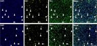Gtf2i-encoded transcription factor Tfii-i regulates myelination via Sox10 and Mbp regulatory elements